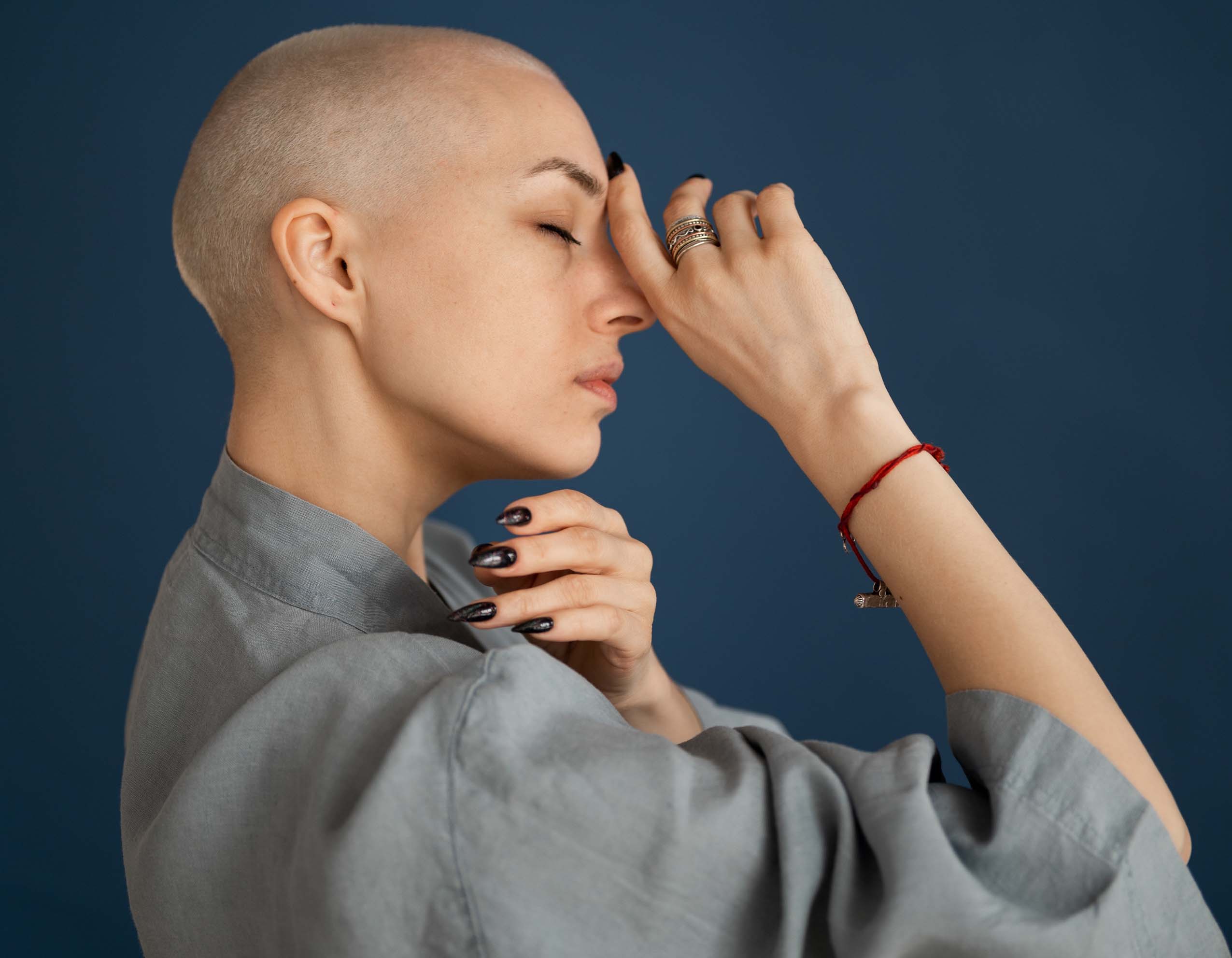 Alopecia femenina